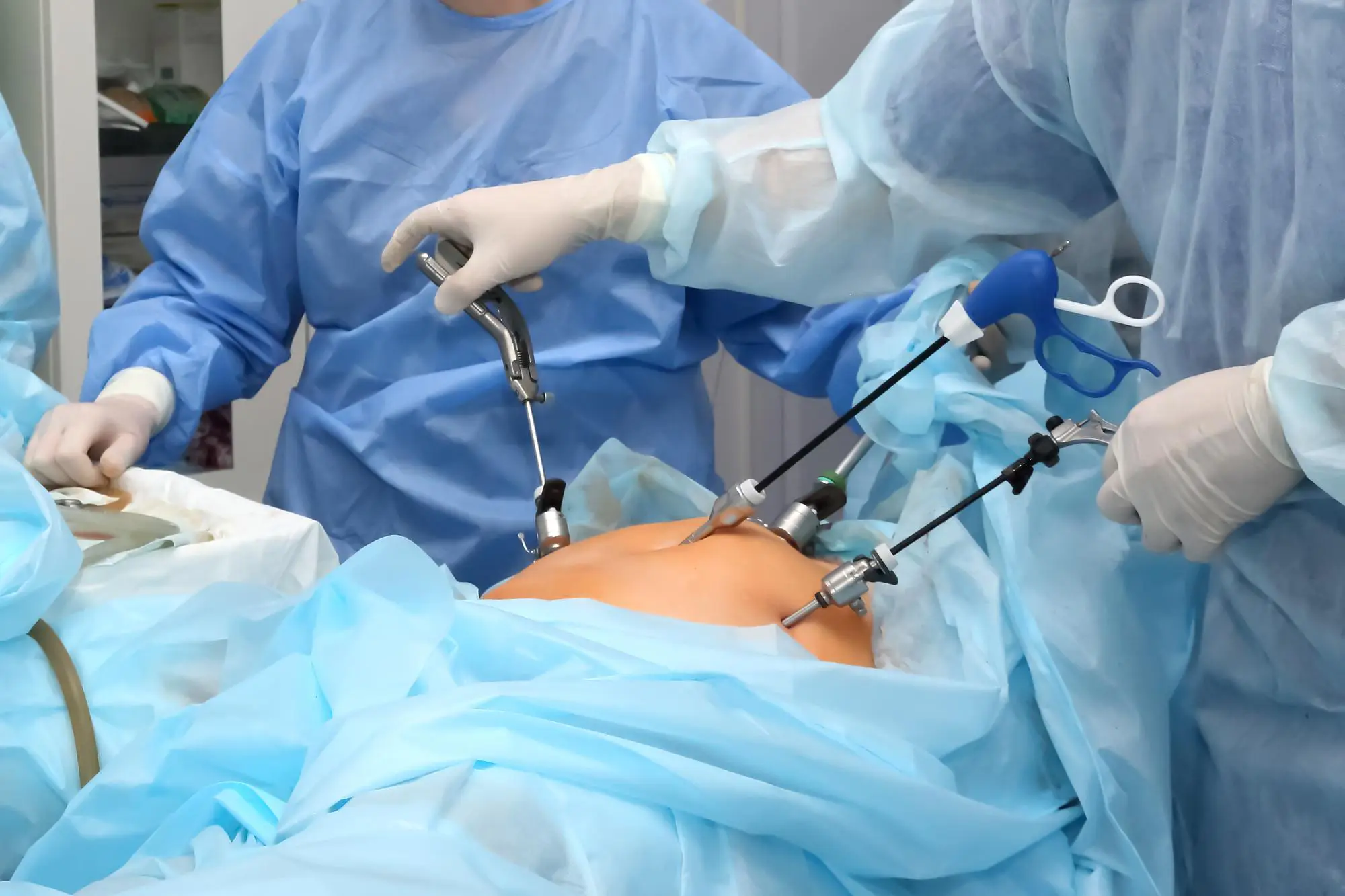 Laparoscopic Surgery (Minimally Invasive Surgery)